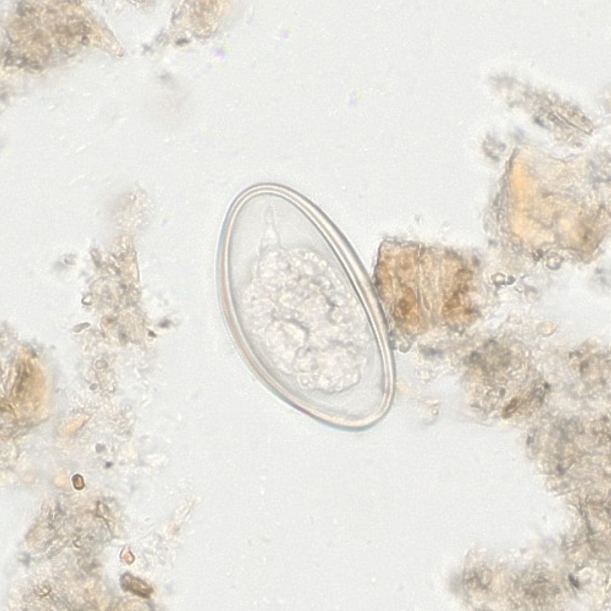 ParaScout AI microscopic image showing a Plano-Convex Enterobius vermicularis egg, AI detection box, automated measurement (55x22 µm), and 94% confidence score.
