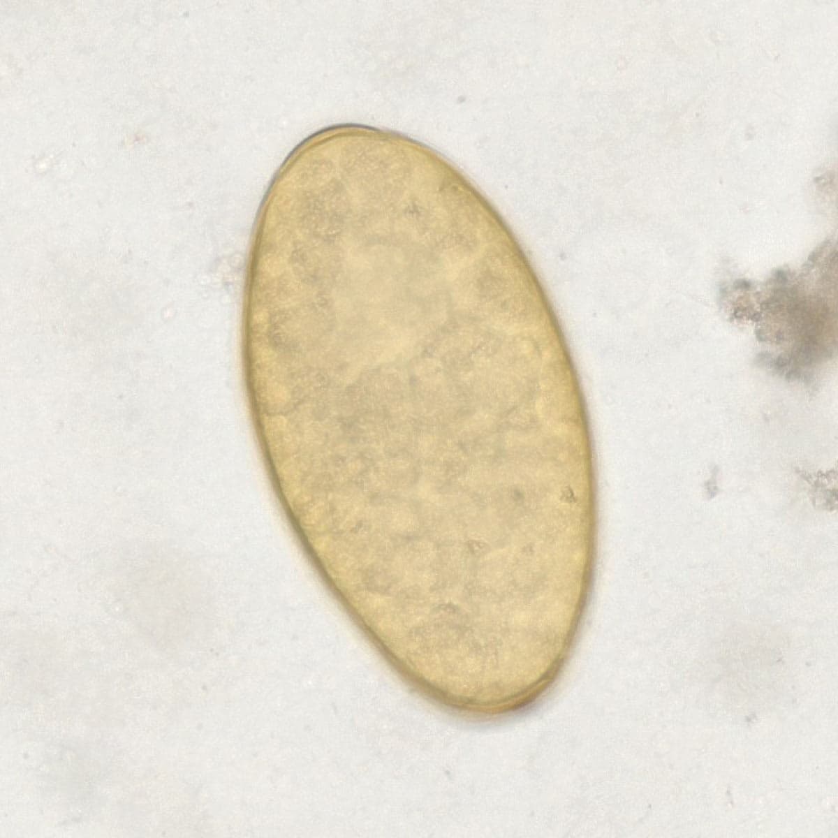 ParaScout AI microscopic image showing a large operculated Fasciola spp. egg, AI detection box, automated measurement (130x68 µm), and 95% confidence score.