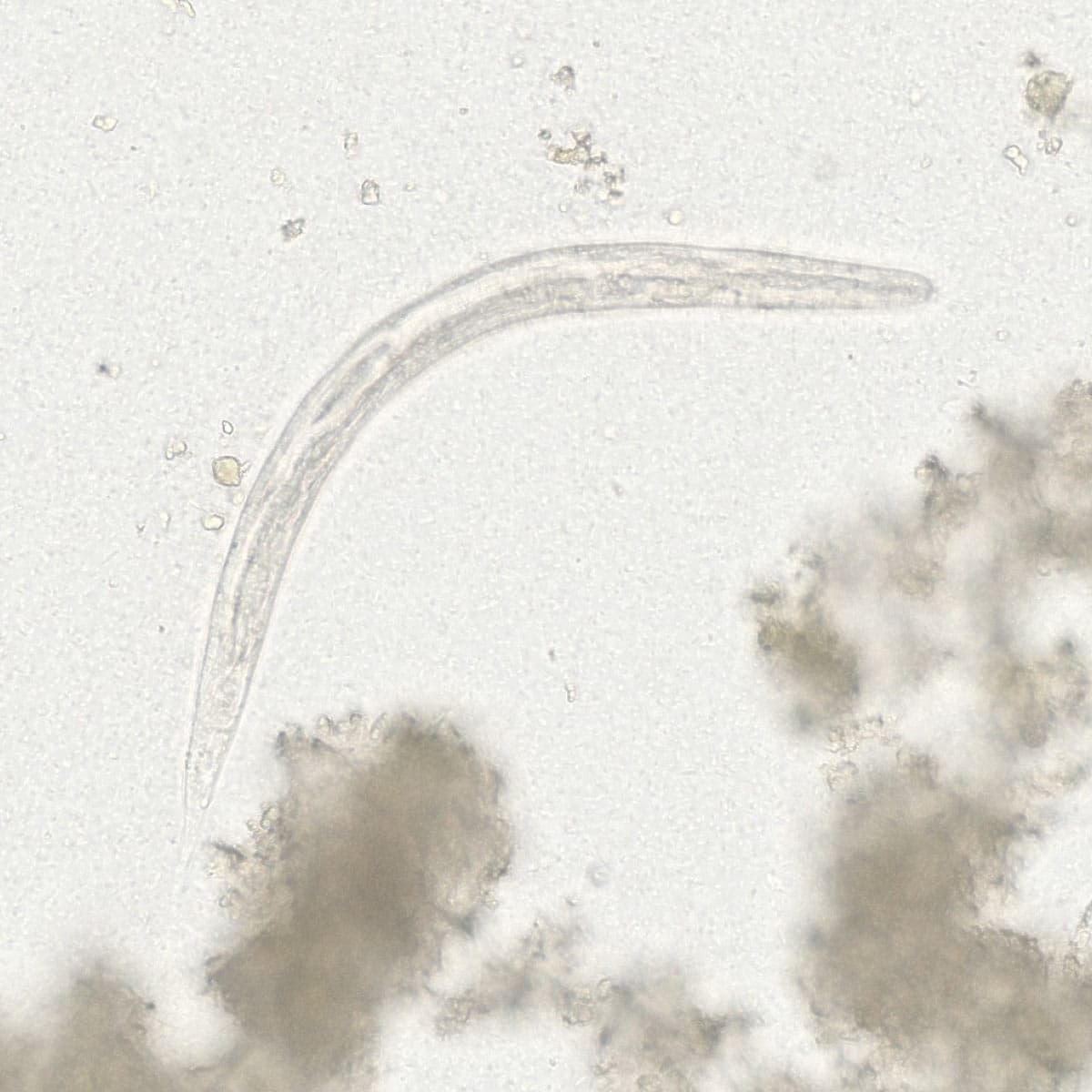 ParaScout AI microscopic image showing the rhabditiform larva of Strongyloides stercoralis, AI detection box, automated measurement 