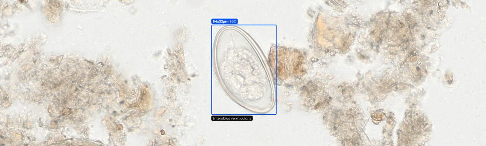 Microscope specimen preview with parasite detection overlay.