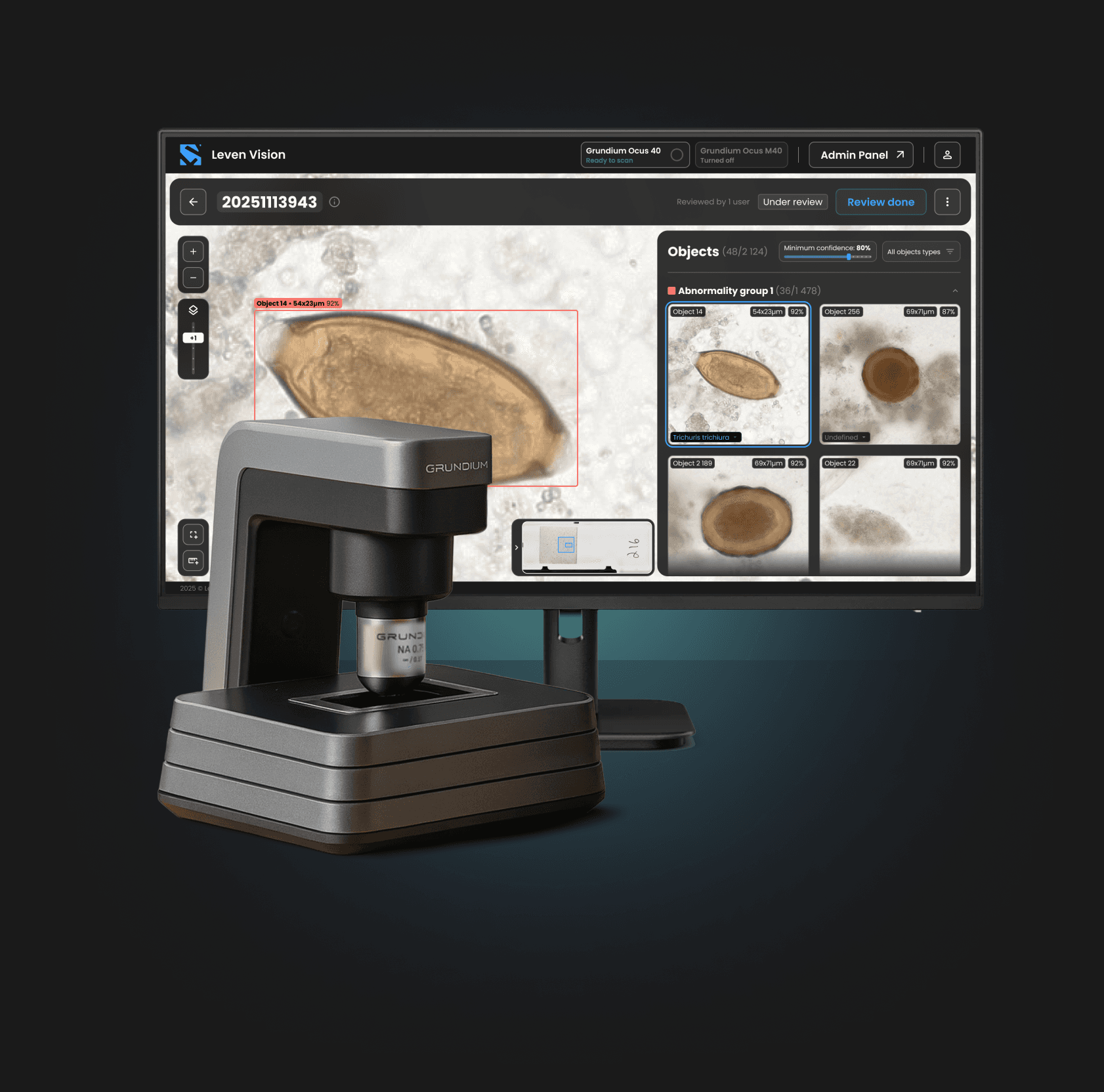 ParaScout AI automated microscope scanner connected to a monitor showing the diagnostic platform with a detected parasite egg and object measurement details.
